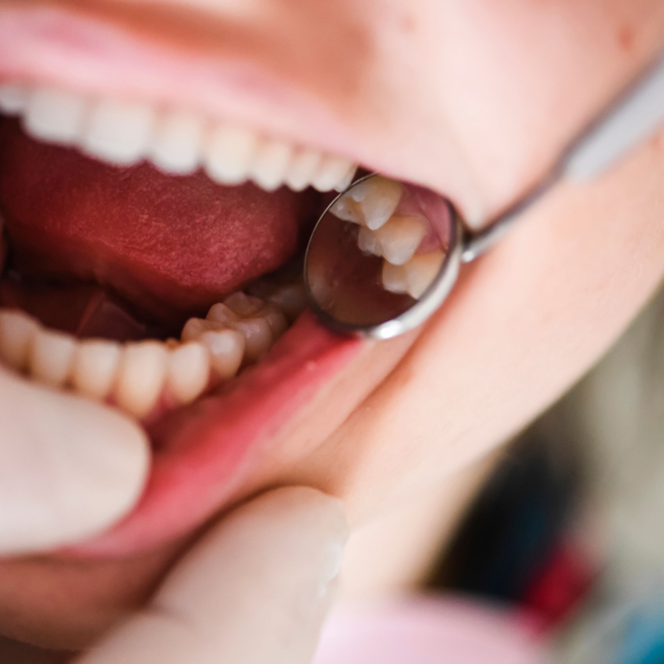 Young female dentist in dental office. Dentist at work. Dental treatment concept.